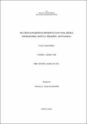 Küçük Resim