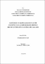 Küçük Resim