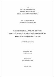 Küçük Resim